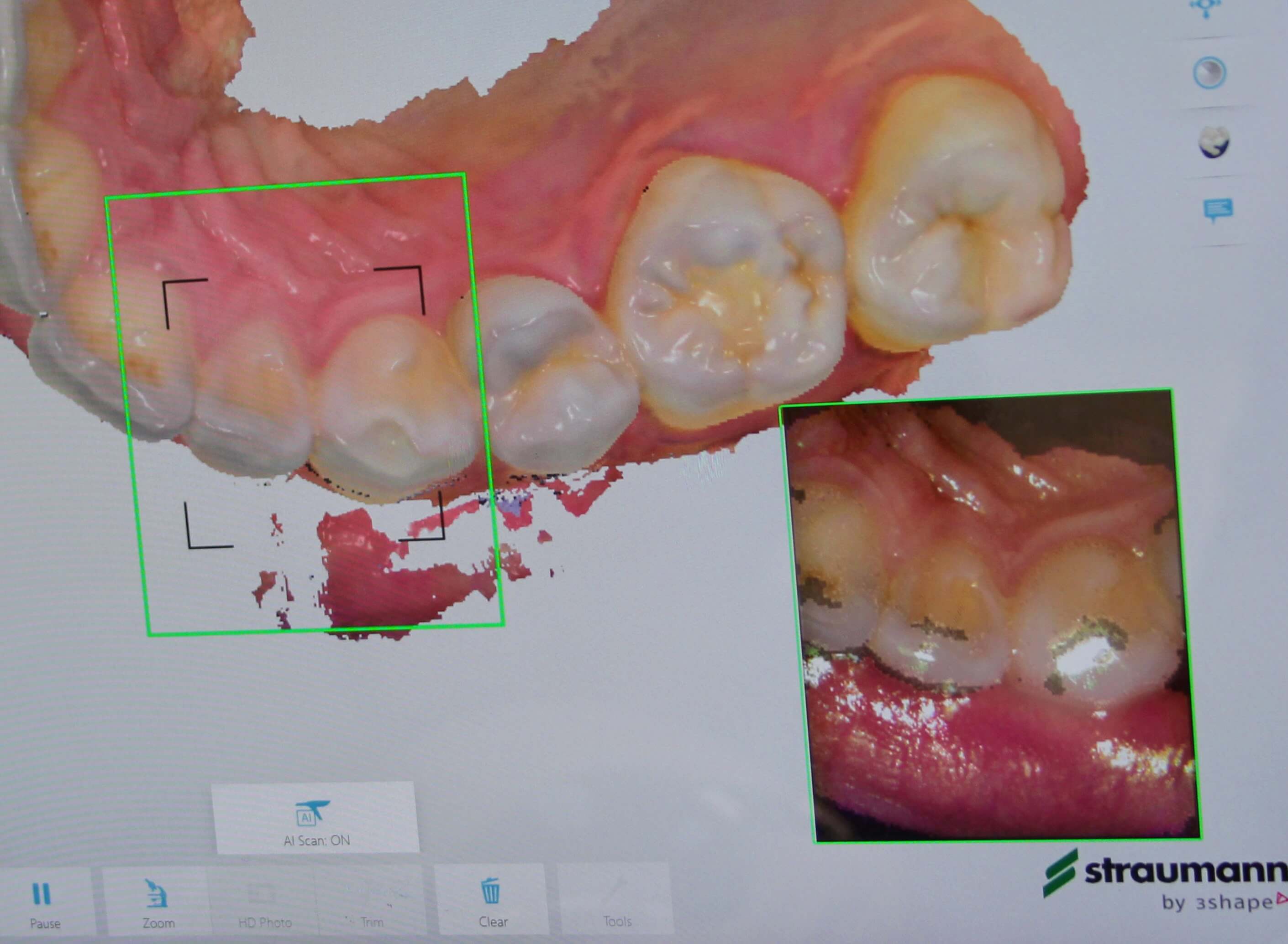 3Shape scanning system at C & H Dental Laboratory