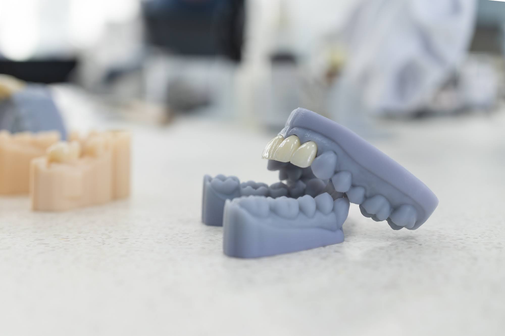 3D printed dental models