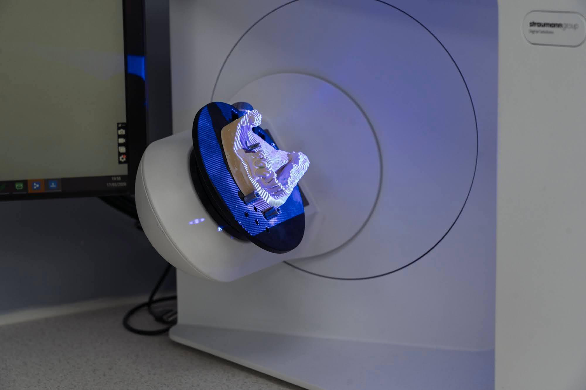 Straumann scanner with model under blue scanning light