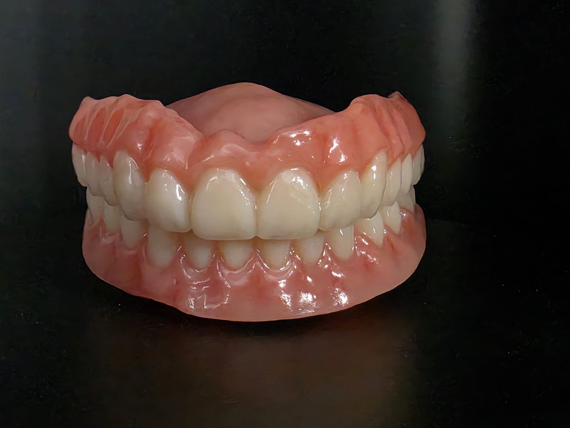 Denture work at C & H Dental Laboratory
