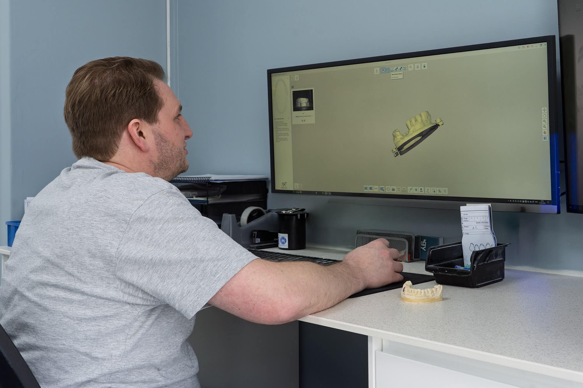 CAD technician designing a dental restoration using 3Shape Dental System