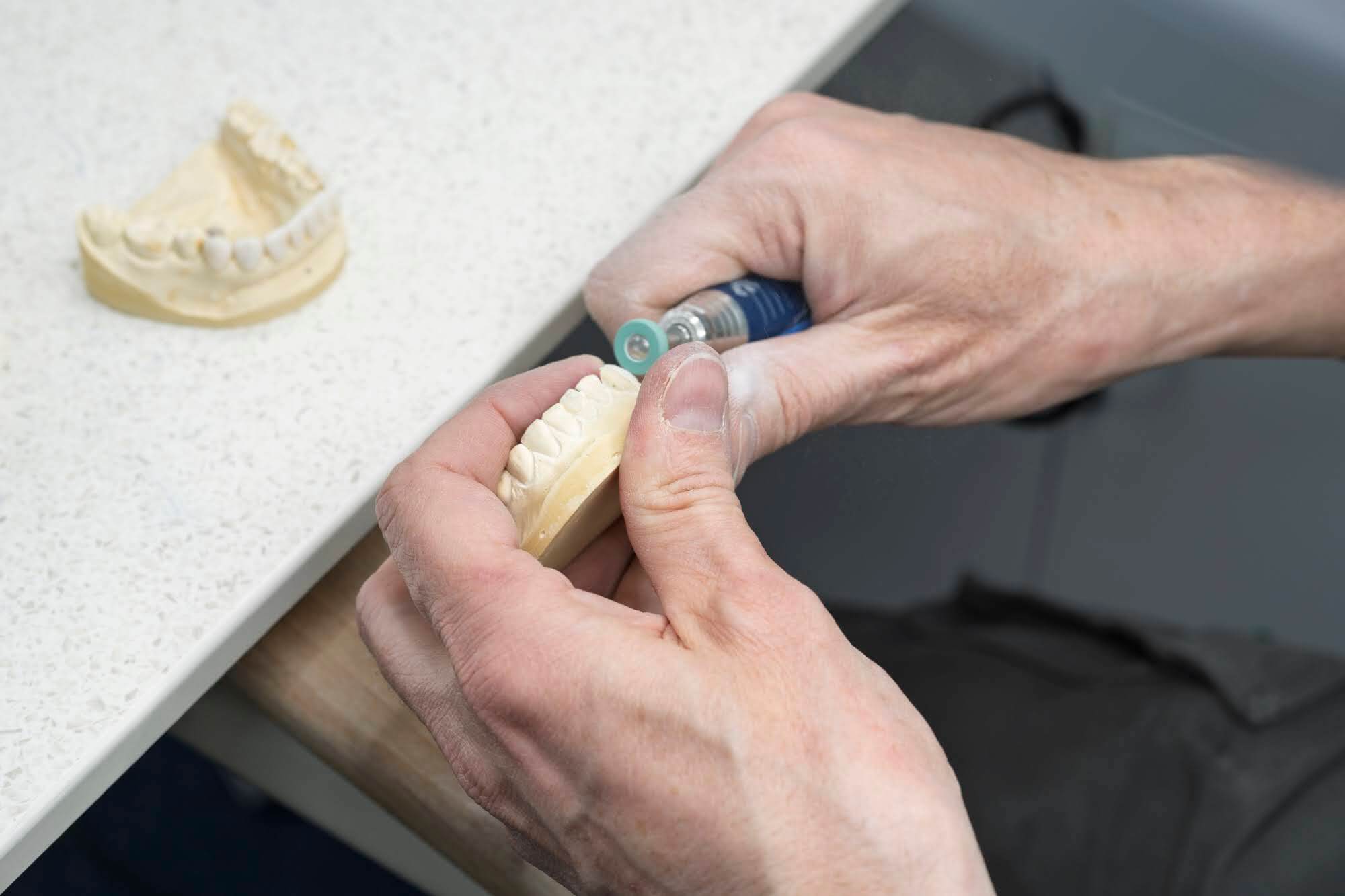 Hand-finishing a crown restoration on a dental model