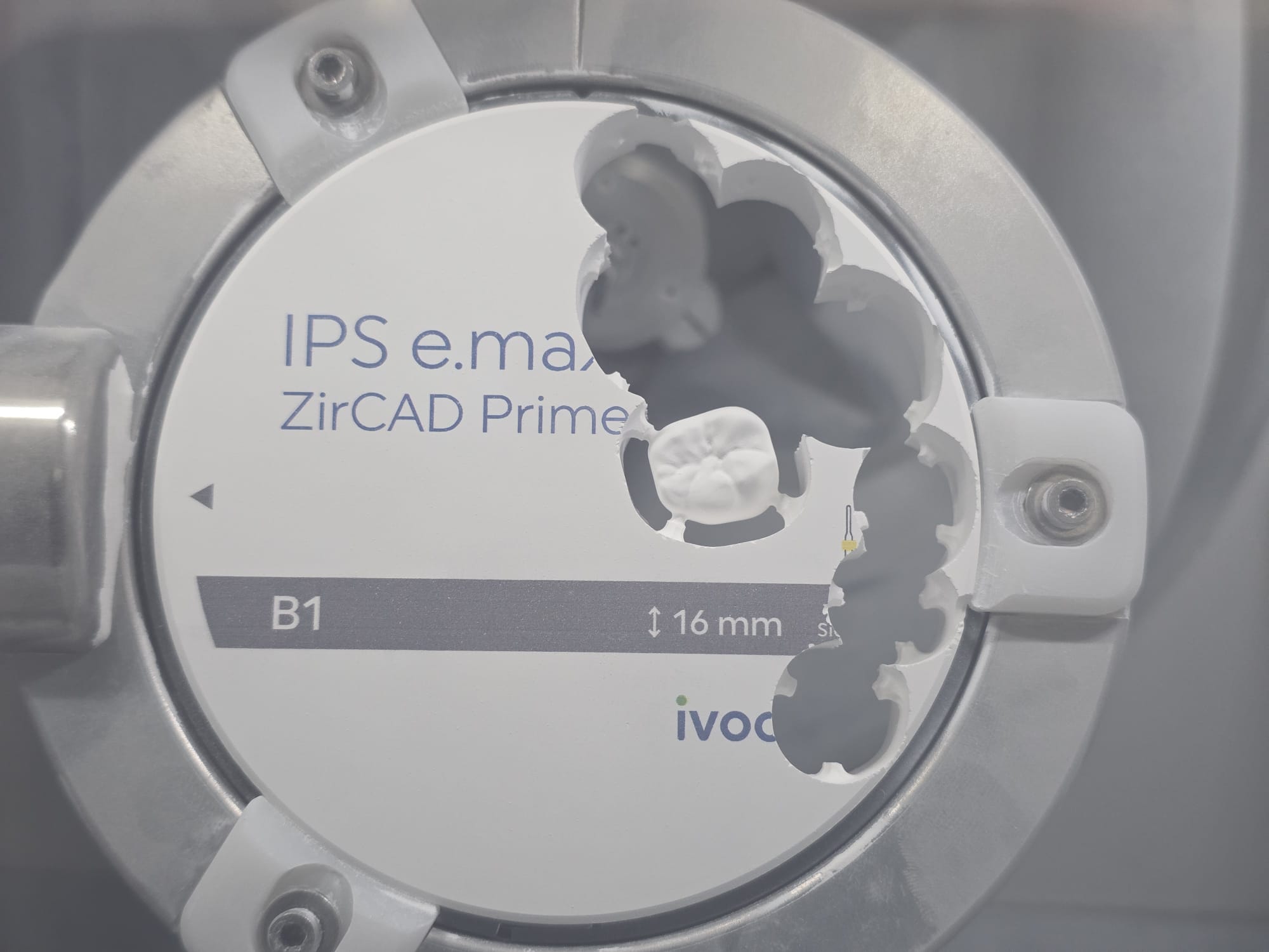 Zirconia crown being milled from an IPS e.max ZirCAD Prime disc
